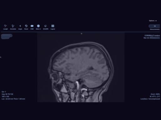 1.2 Million Healthcare Devices Exposed: Patient Scans, Diagnoses Leaked Online