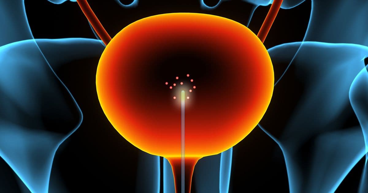 Carbon‑nanotube catheter offers molecular imaging for earlier bladder‑cancer detection