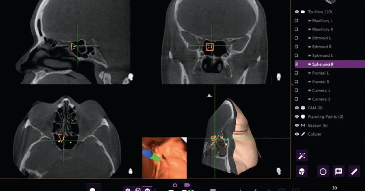 AI-Enhanced Medical Devices Linked to Surge in Surgical Complications, FDA Oversight Questioned