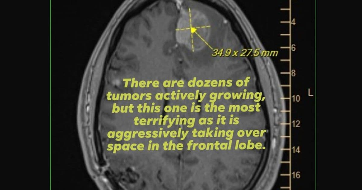 Epic Games Layoffs Leave Terminally Ill Developer Without Life Insurance