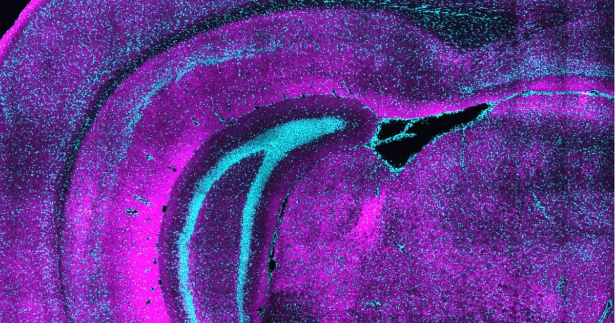 How a unique class of neurons may set the table for brain development