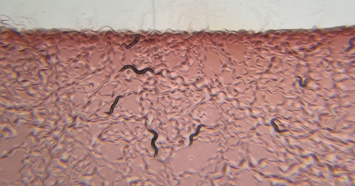 How Neurons Sense Bacteria in the Gut: MIT Research Reveals Key Mechanisms