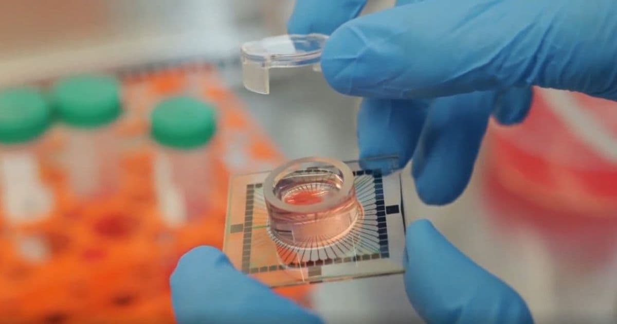 Inside datacenter where day starts with cerebrospinal fluid • The Register