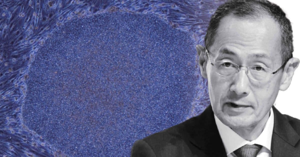 Kyoto University’s iPS Program Faces Calls for Diversification After Two Decades of Yamanaka‑Centric Research
