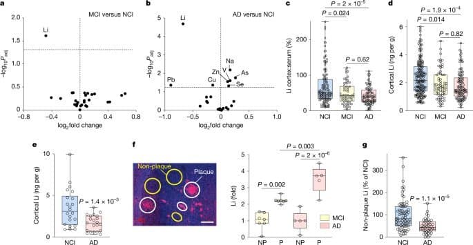 Lithium Deficiency Emerges as Early Trigger in Alzheimer's Pathogenesis, Study Reveals