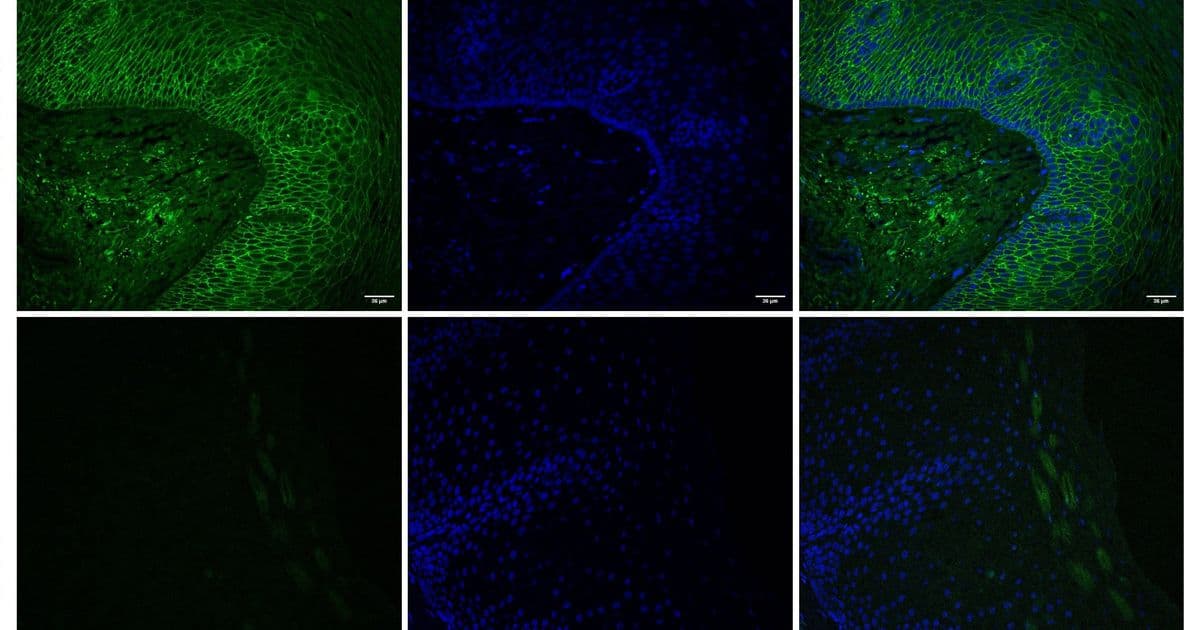 MIT's Esophageal Drug Gel Solves a Mechanical Engineering Problem Disguised as a Medical One