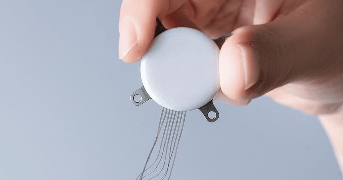 StairMed Raises $72.5 Million: Alibaba and Tencent Back China's Brain-Machine Interface Pioneer