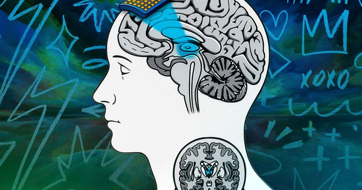 Transcranial Focused Ultrasound Emerges as Key Tool for Consciousness Research