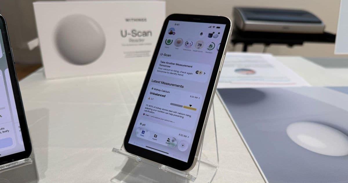 Toilet-Tech Breakthrough: Withings U-SScan Ushers in New Era of Urine-Based Health Analytics