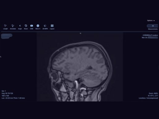 1.2 Million Healthcare Devices Exposed: Patient Scans, Diagnoses Leaked Online