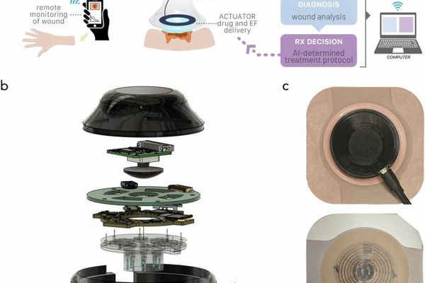 a-Heal: Machine Learning and Bioelectronics Converge for Adaptive Wound Therapy