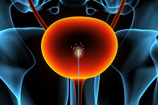 Carbon‑nanotube catheter offers molecular imaging for earlier bladder‑cancer detection