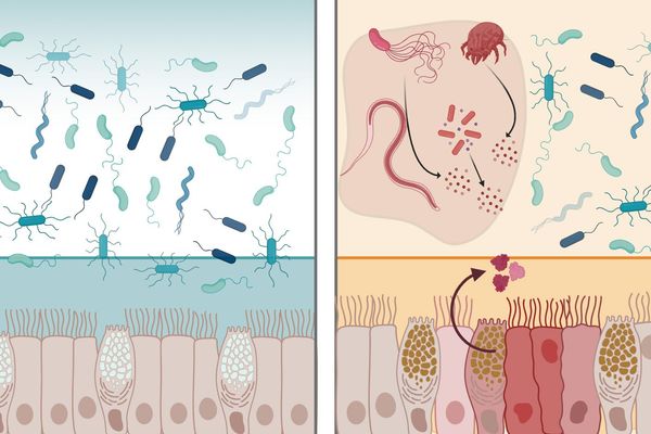 MIT Researchers Identify Intelectin-2 as Dual-Function Antimicrobial Protein in Gut Defense