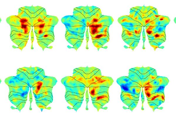 Cerebellum's Hidden Role: MIT Researchers Discover Language Processing Network in Movement Center of the Brain