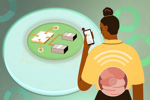 MIT team shrinks ingestible temperature sensor for core body monitoring