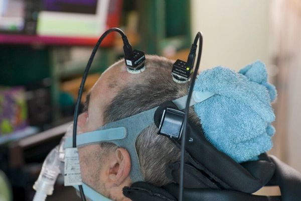 UC Davis team uses AI brain implant to help ALS patient work full time
