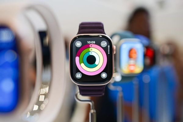 Apple Watch Series 11 Rumors Point to Major Health Tech and AI Advancements