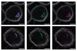 Tuberculosis bacteria