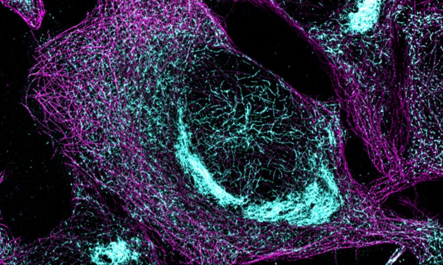 Colorized microscopic image