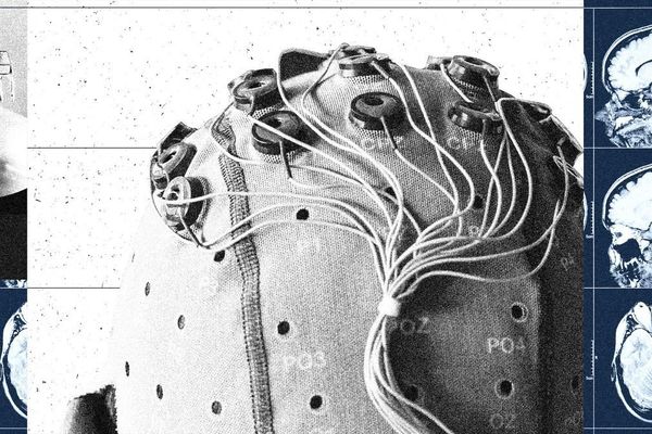 China Accelerates Brain-Computer Interface Race with National Policy Push