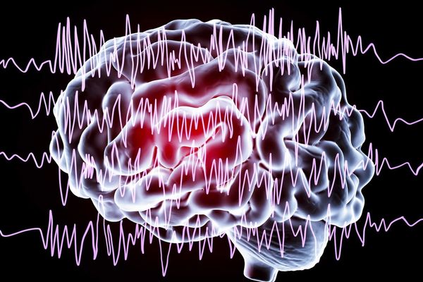 Smart Sleep Mask Security Flaw Exposes Users' Brainwave Data to Strangers