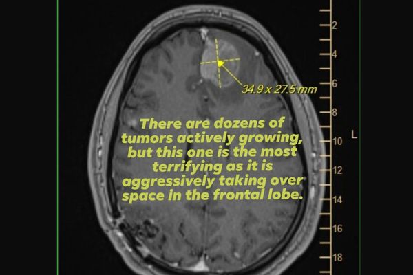 Epic Games Layoffs Leave Terminally Ill Developer Without Life Insurance