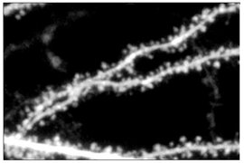 A blurred black-and-white image shows sections of neural dendrites, which appear as long thin lines with many small bumps along them.