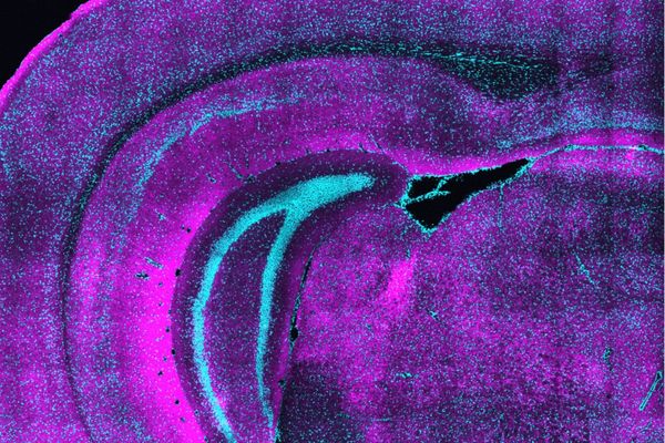 How a unique class of neurons may set the table for brain development
