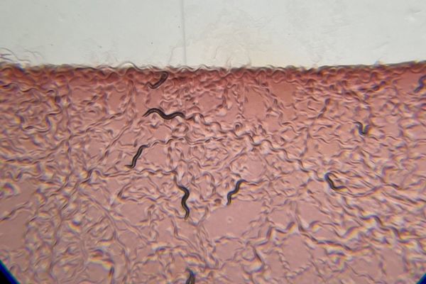 How Neurons Sense Bacteria in the Gut: MIT Research Reveals Key Mechanisms