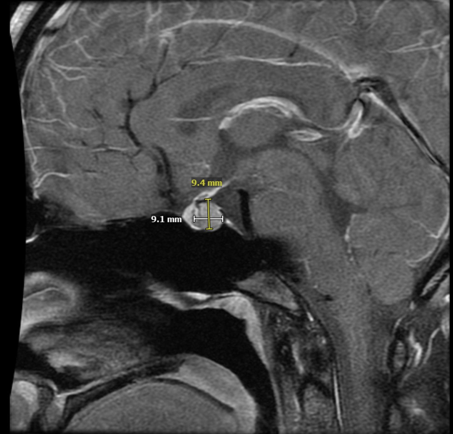 I’m going to cure my girlfriend’s brain tumor. - Andrew