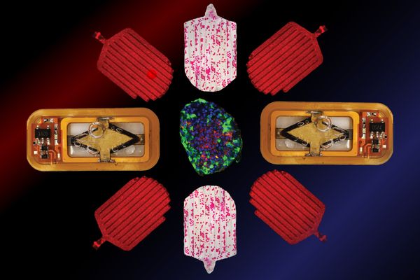 MIT's Implantable Device Could End Daily Insulin Injections for Type 1 Diabetes Patients