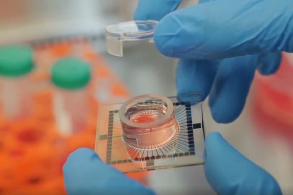 Inside datacenter where day starts with cerebrospinal fluid • The Register