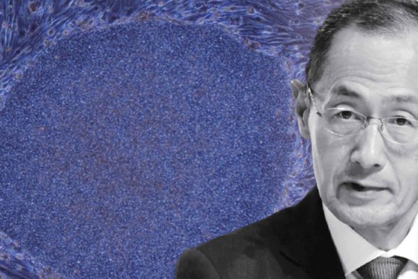 Kyoto University’s iPS Program Faces Calls for Diversification After Two Decades of Yamanaka‑Centric Research