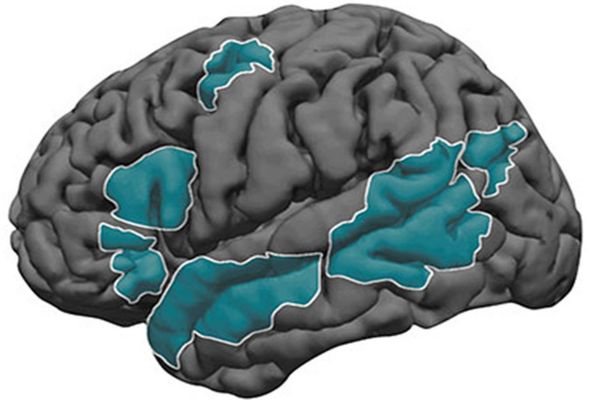 Left-Brain Language Processing Established by Age 4, MIT Research Reveals