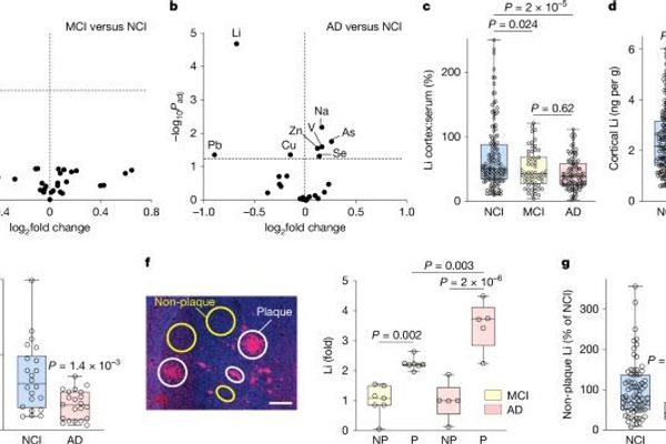 Lithium Deficiency Emerges as Early Trigger in Alzheimer's Pathogenesis, Study Reveals