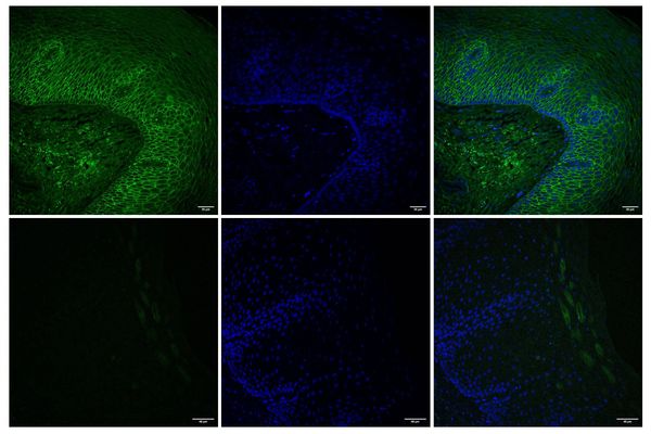 MIT's Esophageal Drug Gel Solves a Mechanical Engineering Problem Disguised as a Medical One