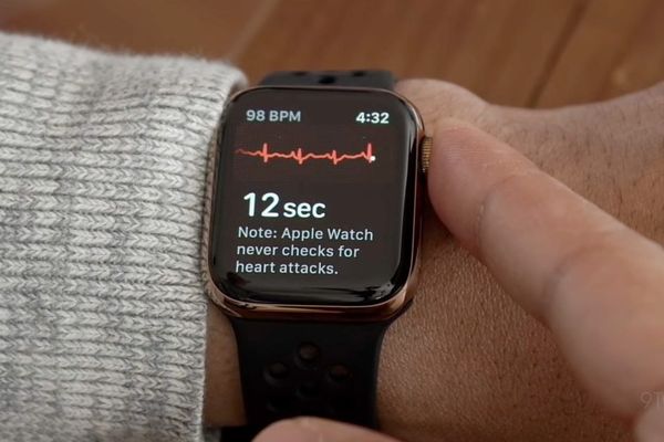 Apple Watch ECG Study Shows Promise for Post-Ablation AFib Monitoring
