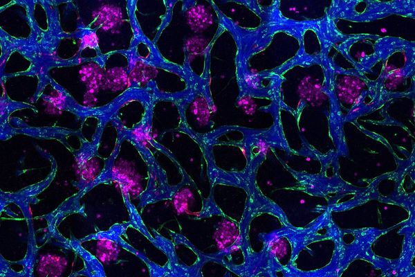 New tissue models could help researchers develop drugs for liver disease | MIT News | Massachusetts Institute of Technology