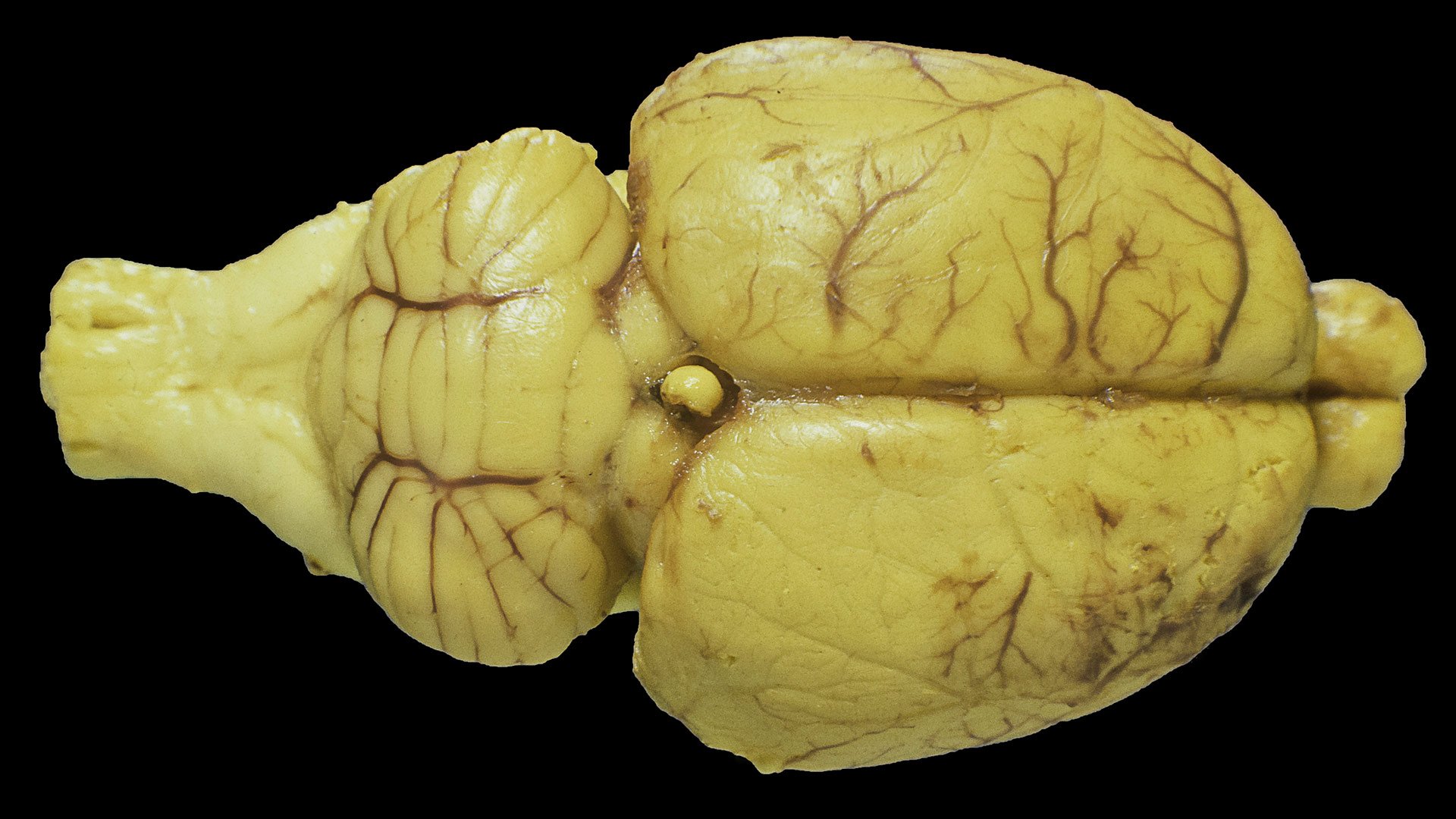 Rat brain