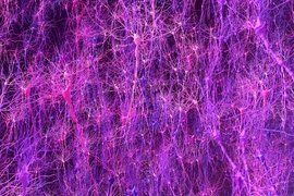 3D rendering shows magenta hued, very branchy neurons densely clustered in tightly-packed circuits.