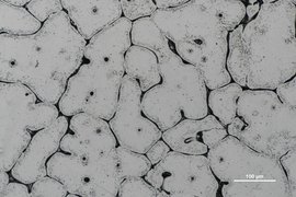 A microscopic view of metal surface captured with a scanning electron microscope, revealing intricate microstructures and grain boundaries