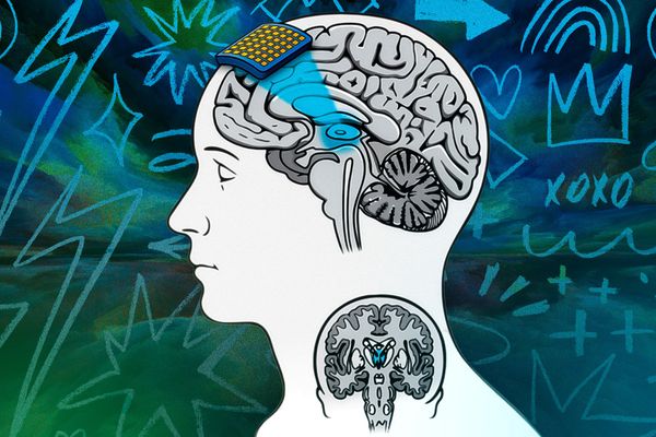 Transcranial Focused Ultrasound Emerges as Key Tool for Consciousness Research