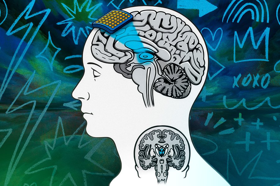 A grid-like patch sits on top of a human head. It sends blue light to a tiny part of the brain.