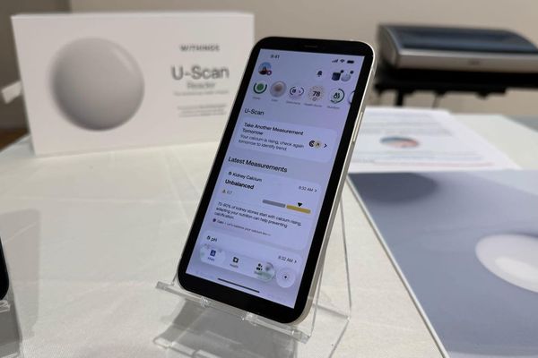 Toilet-Tech Breakthrough: Withings U-SScan Ushers in New Era of Urine-Based Health Analytics